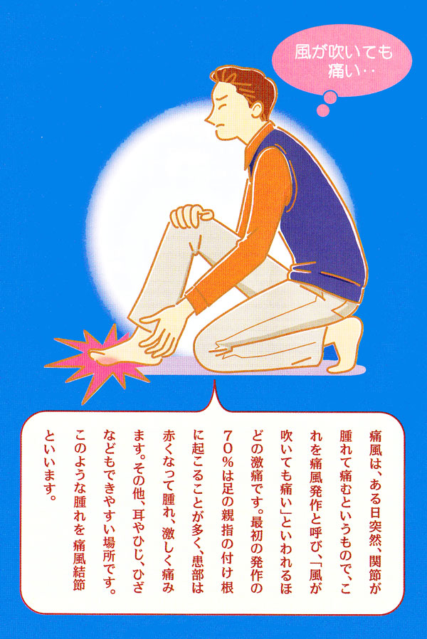 痛風予防のポイント